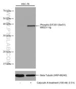 Phospho-EIF2S1 (Ser51) Antibody in Western Blot (WB)