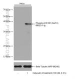 Phospho-EIF2S1 (Ser51) Antibody in Western Blot (WB)