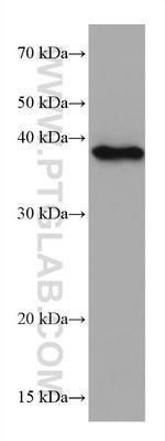 Phospho-EIF2S1 (Ser51) Antibody in Western Blot (WB)