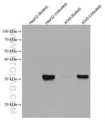 SLC39A3 Antibody in Western Blot (WB)