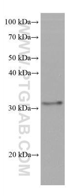 SLC39A3 Antibody in Western Blot (WB)