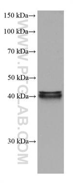 FADS2 Antibody in Western Blot (WB)