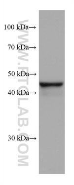 FADS2 Antibody in Western Blot (WB)