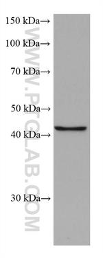 FADS2 Antibody in Western Blot (WB)