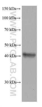 FADS2 Antibody in Western Blot (WB)