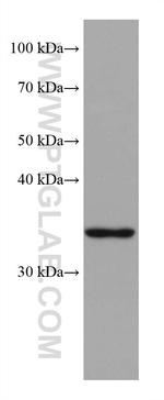 ZFP36L1 Antibody in Western Blot (WB)