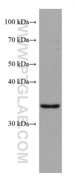 ZFP36L1 Antibody in Western Blot (WB)