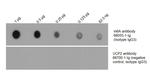 m6A Antibody in Dot Blot (DB)