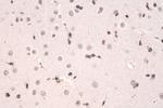 m6A Antibody in Immunohistochemistry (Paraffin) (IHC (P))