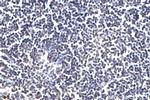 m6A Antibody in Immunohistochemistry (Paraffin) (IHC (P))