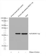 m6A Antibody in Immunoprecipitation (IP)