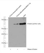 m6A Antibody in Immunoprecipitation (IP)