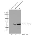 m6A Antibody in Immunoprecipitation (IP)