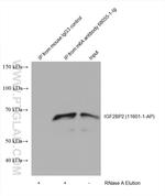 m6A Antibody in Immunoprecipitation (IP)