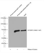 m6A Antibody in Immunoprecipitation (IP)