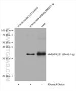 m6A Antibody in Immunoprecipitation (IP)