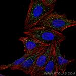 EEA1 Antibody in Immunocytochemistry (ICC/IF)