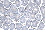 NDUFS3 Antibody in Immunohistochemistry (Paraffin) (IHC (P))