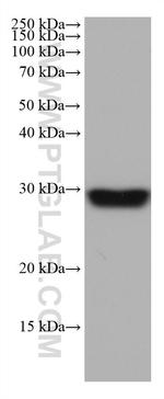 NDUFS3 Antibody in Western Blot (WB)