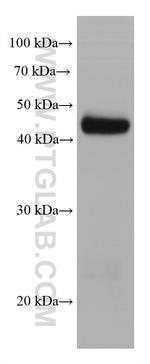 STRA8 Antibody in Western Blot (WB)