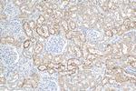 FATP2 Antibody in Immunohistochemistry (Paraffin) (IHC (P))