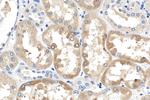 FATP2 Antibody in Immunohistochemistry (Paraffin) (IHC (P))