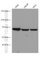 FATP2 Antibody in Western Blot (WB)