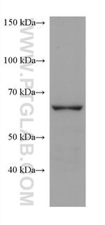 FATP2 Antibody in Western Blot (WB)