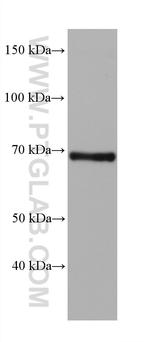 FATP2 Antibody in Western Blot (WB)