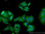 BAG3 Antibody in Immunocytochemistry (ICC/IF)