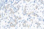 LASP1 Antibody in Immunohistochemistry (Paraffin) (IHC (P))