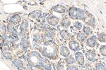 LASP1 Antibody in Immunohistochemistry (Paraffin) (IHC (P))