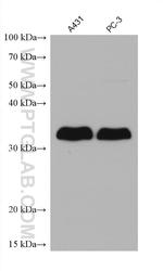 LASP1 Antibody in Western Blot (WB)