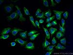 NCAPG Antibody in Immunocytochemistry (ICC/IF)