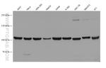 NCAPG Antibody in Western Blot (WB)