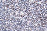 C1QBP Antibody in Immunohistochemistry (Paraffin) (IHC (P))