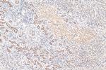 C1QBP Antibody in Immunohistochemistry (Paraffin) (IHC (P))