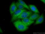 Annexin VI Antibody in Immunocytochemistry (ICC/IF)