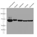 Annexin VI Antibody in Western Blot (WB)