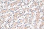 p115, USO1 Antibody in Immunohistochemistry (Paraffin) (IHC (P))