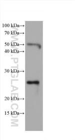 Bcl2 Antibody in Western Blot (WB)