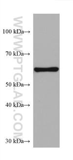 FTO Antibody in Western Blot (WB)