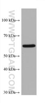 FTO Antibody in Western Blot (WB)