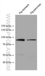 ADAM8 Antibody in Western Blot (WB)