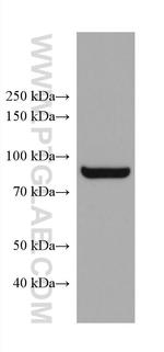ADAM8 Antibody in Western Blot (WB)