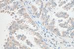 PGAM5 Antibody in Immunohistochemistry (Paraffin) (IHC (P))