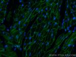 Dystrophin Antibody in Immunohistochemistry (PFA fixed) (IHC (PFA))