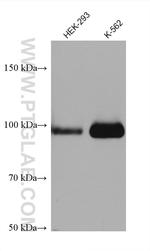 PLA2G4A Antibody in Western Blot (WB)