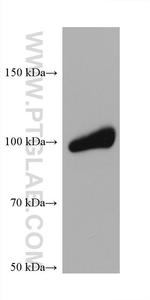 PLA2G4A Antibody in Western Blot (WB)