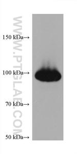 PLA2G4A Antibody in Western Blot (WB)